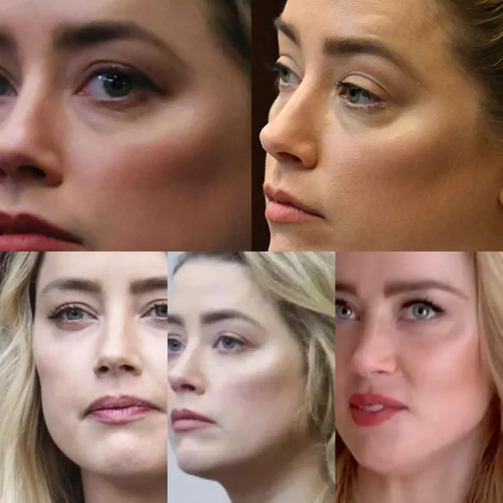 Amber heard said to have cheek implants, image shows different angles of the face