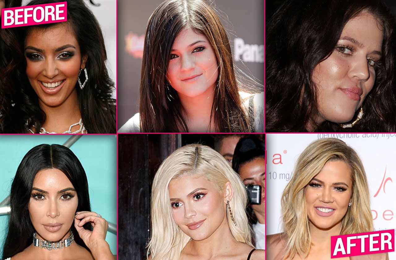 Kardashians plastic surgery