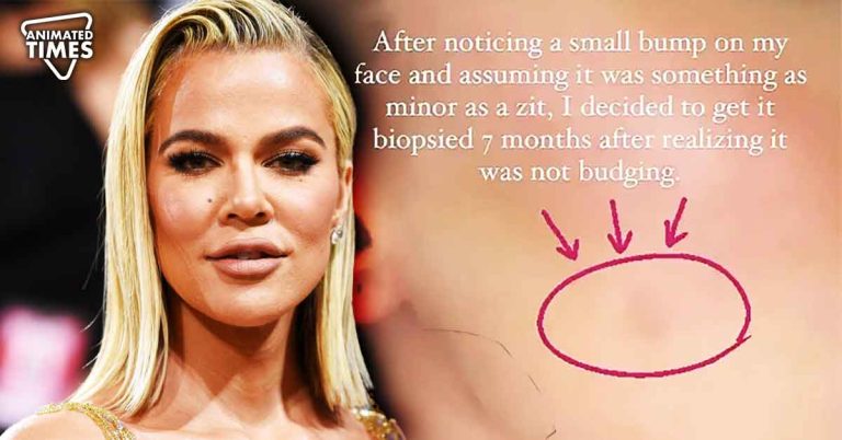 "I had a tumor removed from my face but I’m totally ok": Khloe Kardashian Addresses Fans' Concern Over Her Medical Condition After Tumor Treatment